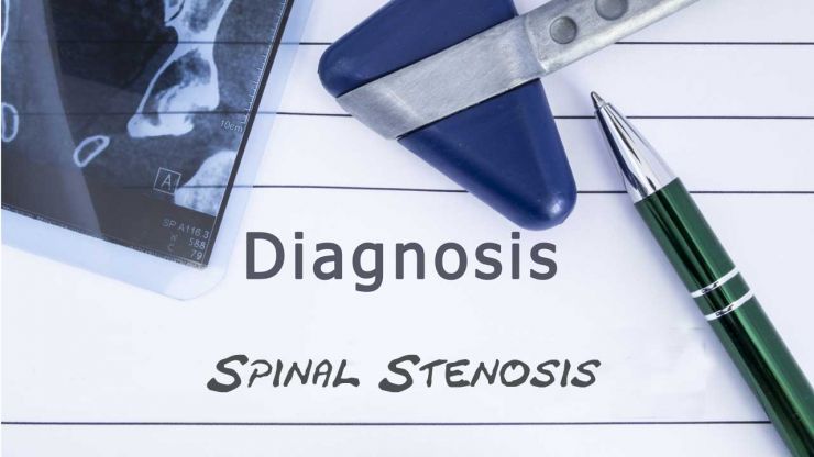 Diagnosis Spinal Stenosis